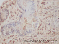 Immunohistochemistry of paraffin-embedded Mouse intestines using PRKCA Polyclonal Antibody at dilution of 1:50