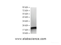 Western Blot analysis of MCF7 cells using MGMT Polyclonal Antibody at dilution of 1:600
