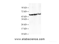 Western Blot analysis of HeLa, A549 and 293T cells using TCP1 Polyclonal Antibody at dilution of 1:600