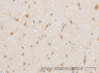 Immunohistochemistry of paraffin-embedded Mouse brain using TRIP4 Polyclonal Antibody at dilution of 1:50