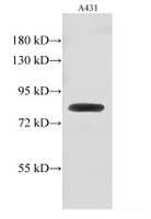 Western Blot analysis of A431 cell using GUSB Polyclonal Antibody at dilution of 1:500