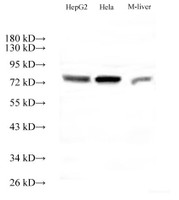 Western Blot analysis of HepG2, Hela cells and Mouse liver tissue using ACTN4 Polyclonal Antibody at dilution of 1:500