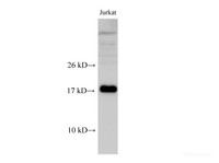 Western Blot analysis of Jurkat cell using RPS25 Polyclonal Antibody at dilution of 1:500