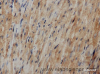 Immunohistochemistry of paraffin-embedded Mouse heart using IL6 Polyclonal Antibody at dilution of 1:50