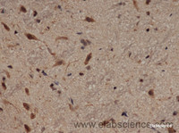 Immunohistochemistry of paraffin-embedded Rat brain using Lep Polyclonal Antibody at dilution of 1:50