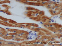 Immunohistochemistry of paraffin-embedded Rat heart using TNNT2 Polyclonal Antibody at dilution of 1:50