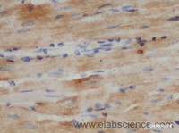 Immunohistochemistry of paraffin-embedded Mouse heart using TNNT2 Polyclonal Antibody at dilution of 1:50