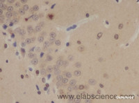 Immunohistochemistry of paraffin-embedded Rat brain using SOX-2 Polyclonal Antibody at dilution of 1:50