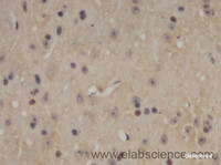 Immunohistochemistry of paraffin-embedded Mouse brain using SOX-2 Polyclonal Antibody at dilution of 1:50