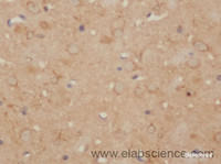 Immunohistochemistry of paraffin-embedded Rat brain using CD86 Polyclonal Antibody at dilution of 1:50