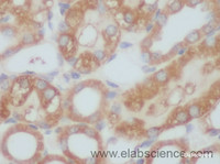 Immunohistochemistry of paraffin-embedded Rat kidney using Vimentin Polyclonal Antibody at dilution of 1:50