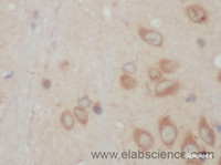 Immunohistochemistry of paraffin-embedded Mouse brain using ACSBG1 Polyclonal Antibody at dilution of 1:50