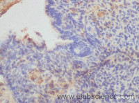 Immunohistochemistry of paraffin-embedded Mouse ovary using IGF2BP2 Polyclonal Antibody at dilution of 1:50
