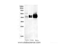 Western Blot analysis of Mouse spleen, Rat kidney and HeLa cells using Casp12 Polyclonal Antibody at dilution of 1:600