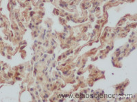 Immunohistochemistry of paraffin-embedded Rat lung using SERPINE1 Polyclonal Antibody at dilution of 1:50