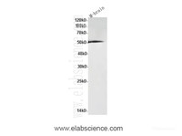 Western Blot analysis of Mouse brain using GDI2 Polyclonal Antibody at dilution of 1:600