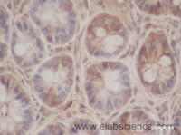 Immunohistochemistry of paraffin-embedded Mouse intestines using CXCL3 Polyclonal Antibody at dilution of 1:50
