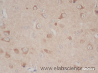 Immunohistochemistry of paraffin-embedded Mouse brain using TLR1 Polyclonal Antibody at dilution of 1:50