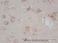 Immunohistochemistry of paraffin-embedded Rat brain using TLR1 Polyclonal Antibody at dilution of 1:50