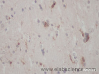 Immunohistochemistry of paraffin-embedded Mouse brain using CORO1A Polyclonal Antibody at dilution of 1:50