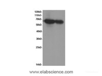 Western Blot analysis of HepG-2 cells and Mouse kidney tissue using IgA Polyclonal Antibody at dilution of 1:600