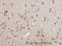 Immunohistochemistry of paraffin-embedded Rat brain using EGR2 Polyclonal Antibody at dilution of 1:50