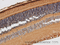 Immunohistochemistry of paraffin-embedded Rat retina using RBP3 Polyclonal Antibody at dilution of 1:50