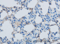 Immunohistochemistry of paraffin-embedded Mouse lung using EBI3 Polyclonal Antibody at dilution of 1:50