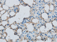 Immunohistochemistry of paraffin-embedded Rat lung using EBI3 Polyclonal Antibody at dilution of 1:50