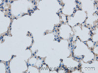 Immunohistochemistry of paraffin-embedded Mouse lung using MMP1 Polyclonal Antibody at dilution of 1:50