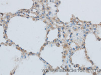 Immunohistochemistry of paraffin-embedded Rat lung using MMP1 Polyclonal Antibody at dilution of 1:50