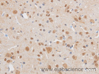 Immunohistochemistry of paraffin-embedded Mouse brain using SIX1 Polyclonal Antibody at dilution of 1:50