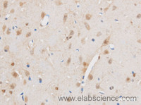 Immunohistochemistry of paraffin-embedded Mouse brain using THRAP3 Polyclonal Antibody at dilution of 1:50