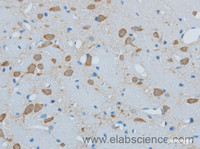 Immunohistochemistry of paraffin-embedded Mouse brain using TIMP4 Polyclonal Antibody at dilution of 1:50