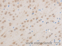 Immunohistochemistry of paraffin-embedded Mouse brain using EIF5A2 Polyclonal Antibody at dilution of 1:50