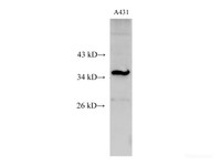 Western Blot analysis of A431 cell using C15orf23 Polyclonal Antibody at dilution of 1:500
