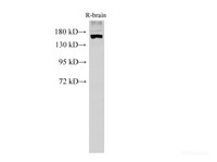 Western Blot analysis of Rat brain tissue using PARD3A Polyclonal Antibody at dilution of 1:500