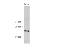 Western Blot analysis of Jurkat cell using SAT1 Polyclonal Antibody at dilution of 1:500