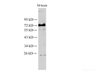 Western Blot analysis of Mouse brain tissue using SDHA Polyclonal Antibody at dilution of 1:500