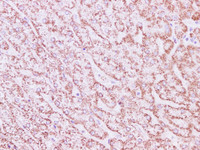 Immunohistochemistry of paraffin-embedded Human liver tissue using SDHA Polyclonal Antibody at dilution of 1:200