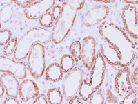 Immunohistochemistry of paraffin-embedded Human kidney tissue using SDHA Polyclonal Antibody at dilution of 1:200