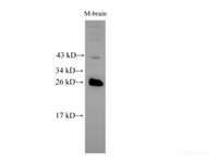 Western Blot analysis of Mouse brain tissue using RAB5B Polyclonal Antibody at dilution of 1:500