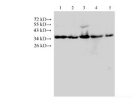 Western Blot analysis of Hela, A431, HepG2, k562 and Raw264.7 cells using ANXA5 Polyclonal Antibody at dilution of 1:500