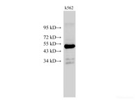 Western Blot analysis of k562 cell using CK-18 Polyclonal Antibody at dilution of 1:500
