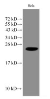 Western Blot analysis of Hela cell using IMP3 Polyclonal Antibody at dilution of 1:1000
