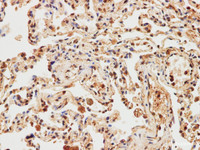 Immunohistochemistry of paraffin-embedded Human lung using IMP3 Polyclonal Antibody at dilution of 1:200