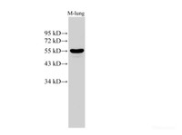 Western Blot analysis of Mouse lung using CK-8 Polyclonal Antibody at dilution of 1:500