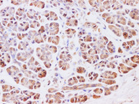 Immunohistochemistry of paraffin-embedded Human pancreas using HSF27 Polyclonal Antibody at dilution of 1:200