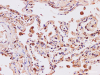 Immunohistochemistry of paraffin-embedded Human lung using ITPKB Polyclonal Antibody at dilution of 1:200