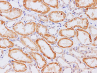 Immunohistochemistry of paraffin-embedded Human kidney using MMP3 Polyclonal Antibody at dilution of 1:200